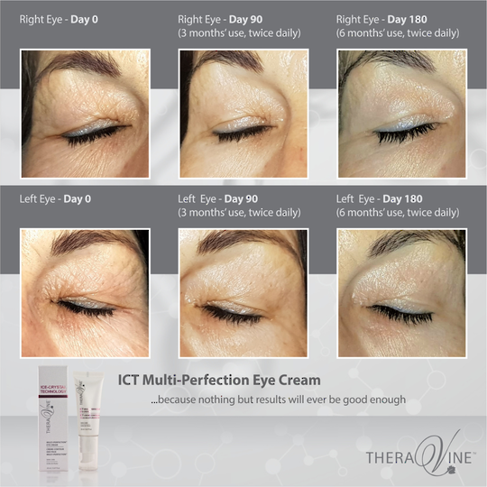 Theravine RETAIL ICT Multi-Perfection-4 Eye Cream image 1